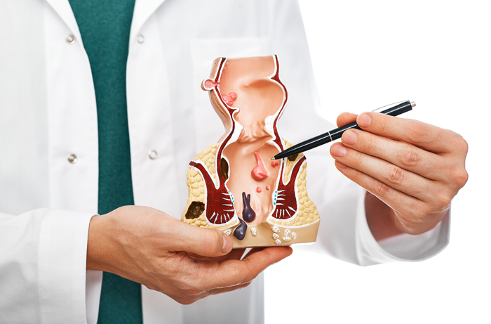 A clinician in a white coat holding an anatomical model of the anal canal and pointing to it with a pen